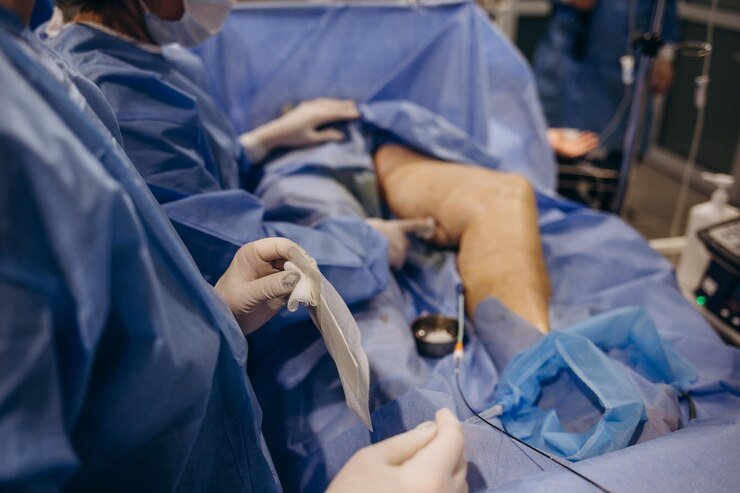 Best Arthroscopy surgery in Sector 41, Noida