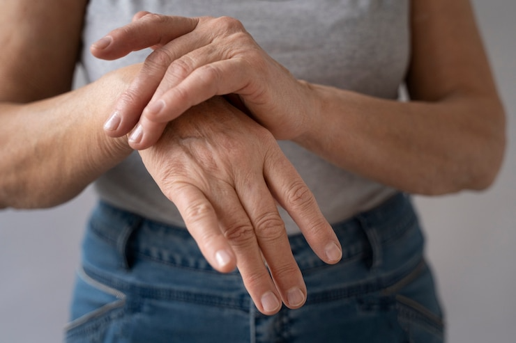 Best Arthritis treatment in Noida