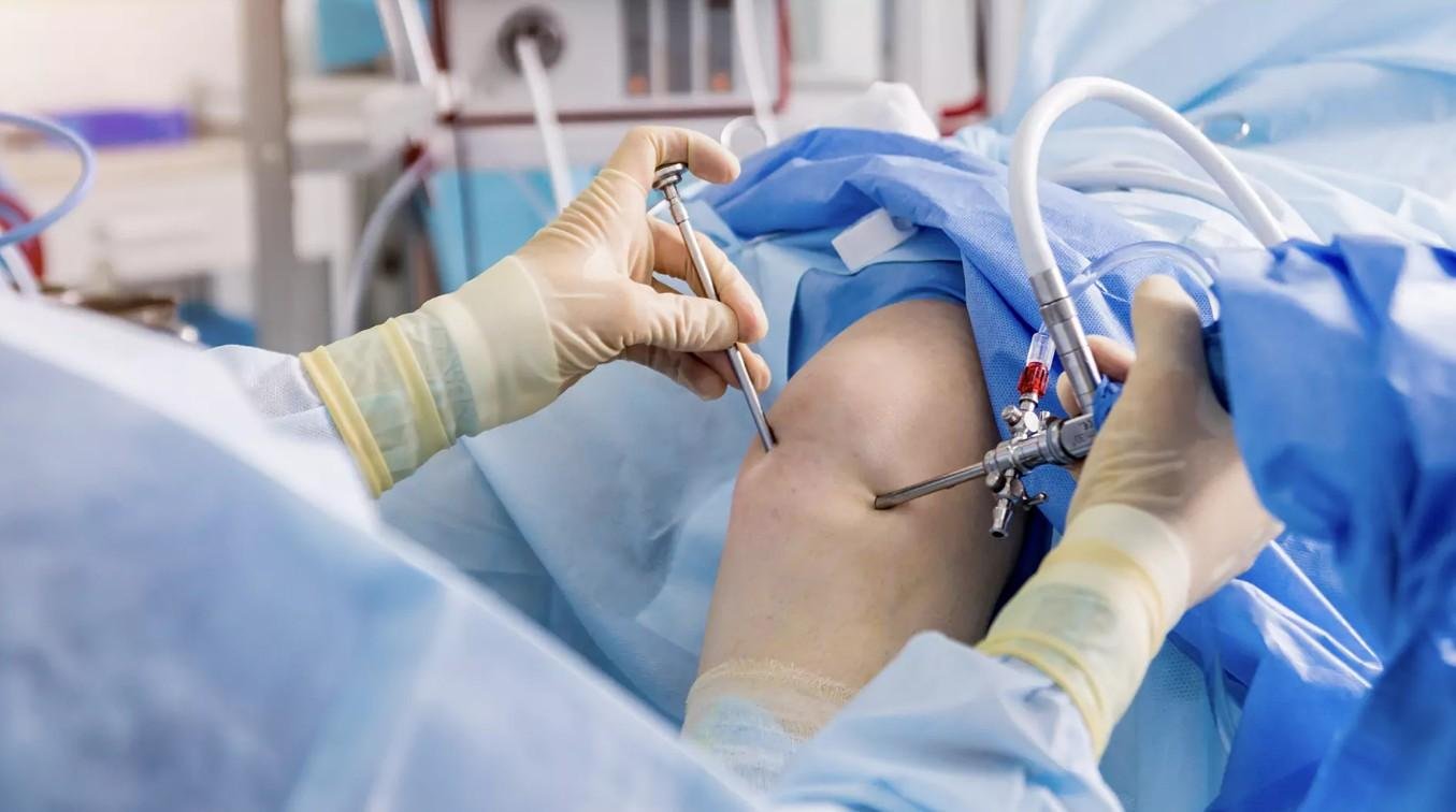 Best Arthroscopy Treatment in Noida