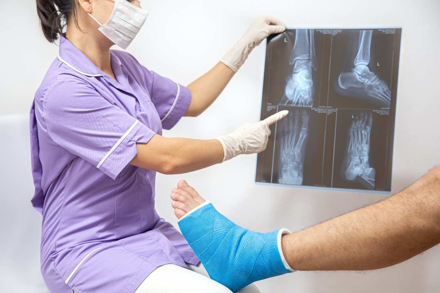 Best Fracture Doctor in Noida